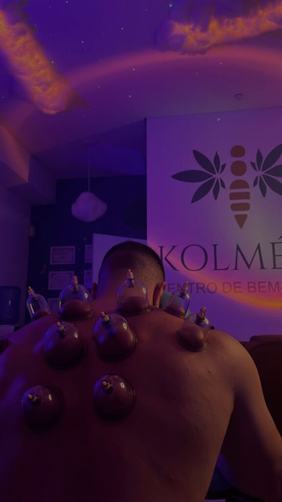 Ventosas aplicadas nas costas de um cliente em sala da Kolmeeia